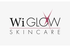 Wiglow Blog Logo